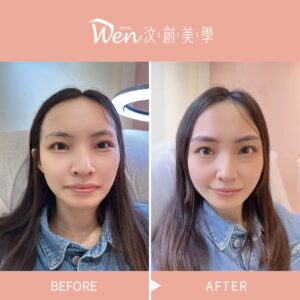 高雄霧眉南科內勤女孩霧眉案例