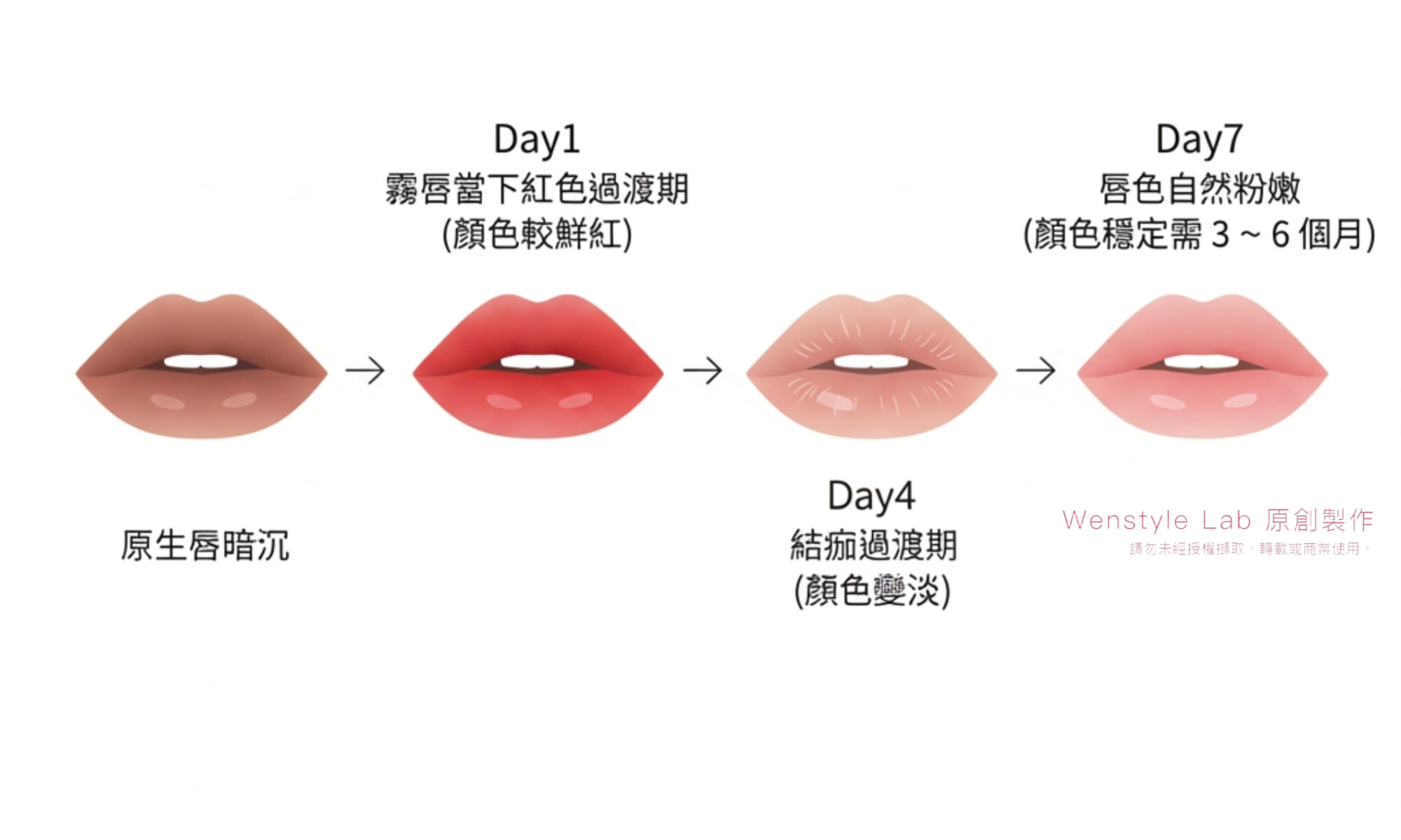 霧唇修復期