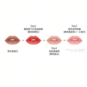 霧唇修復期