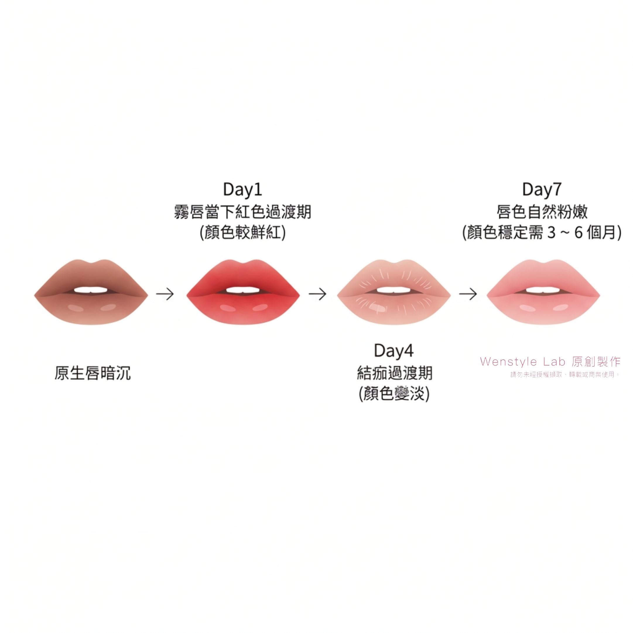 霧唇修復期